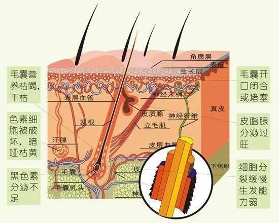 夏季是脫發高峰期 教你科學預防不掉發