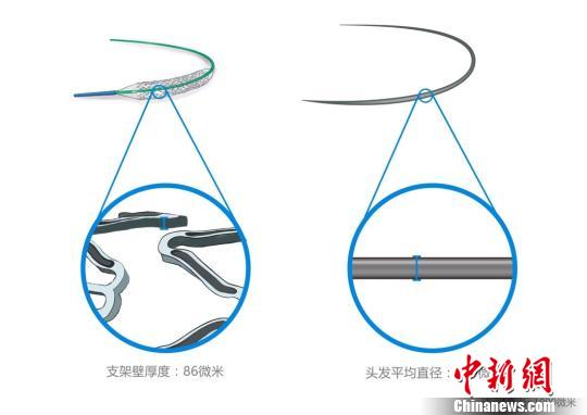 火鷹支架壁的凹槽與頭發直徑對比圖。　供圖 攝